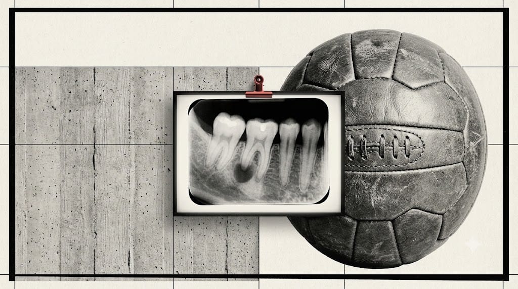 illustration of a dental X-ray showing infection at a tooth root beside a vintage soccer ball