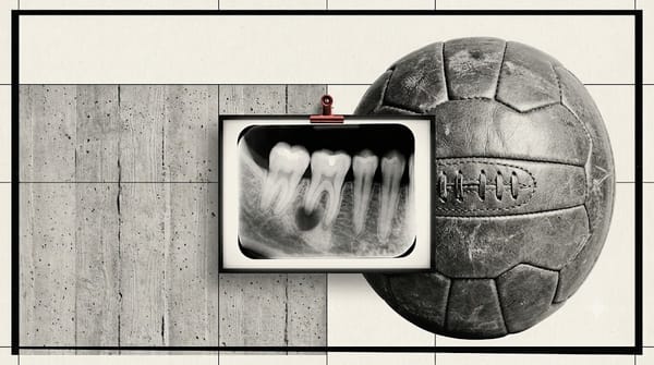 illustration of a dental X-ray showing infection at a tooth root beside a vintage soccer ball